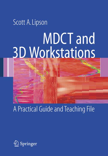 MDCT and 3D Workstations