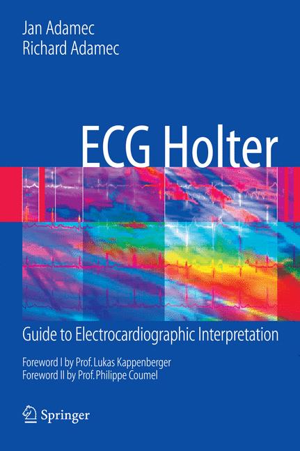 Ecg Holter
