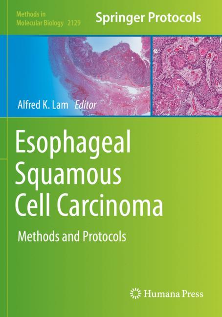 Esophageal Squamous… - image