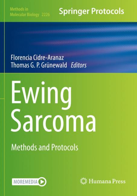 Ewing Sarcoma
