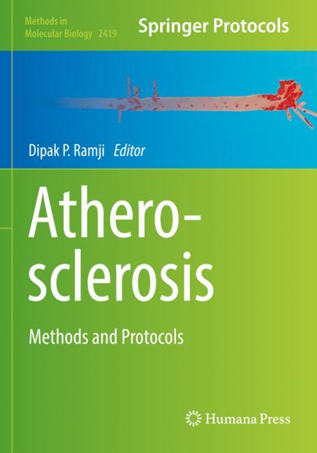 ISBN 9781071619261 product image for Atherosclerosis | upcitemdb.com