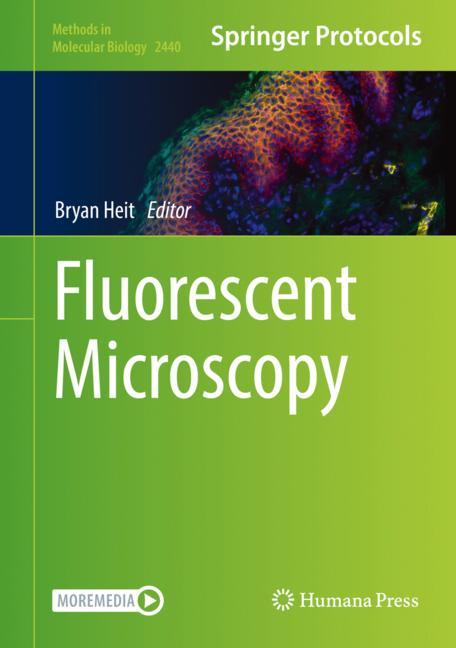 Fluorescent Microsc…