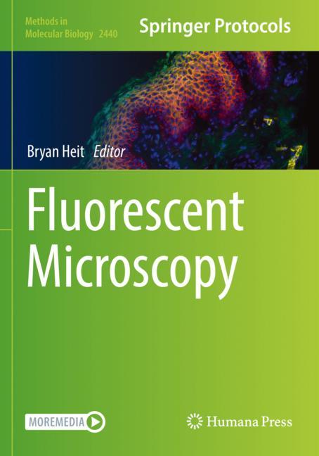 Fluorescent Microsc…
