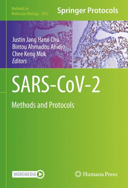Sars-Cov-2 - image