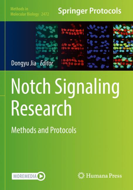 Notch Signaling Res…