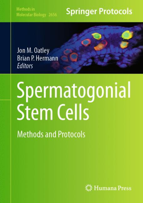 Spermatogonial Stem…