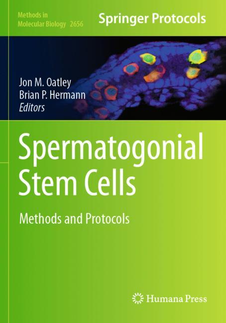 Spermatogonial Stem…