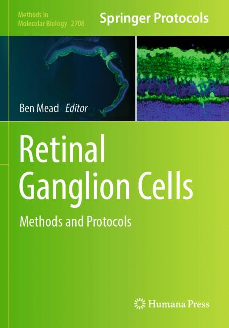 Retinal Ganglion Ce… - image