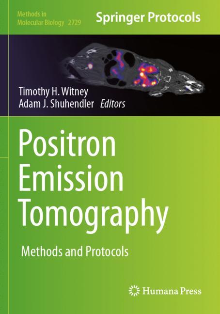 Positron Emission T…