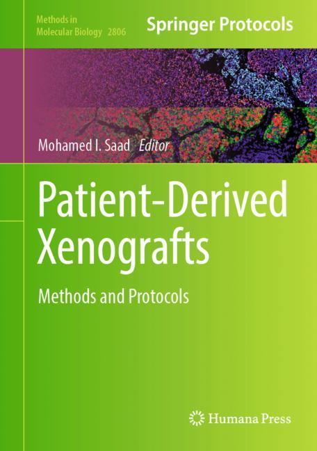 Patient-Derived Xen…