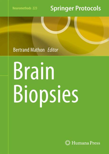 Brain Biopsies
