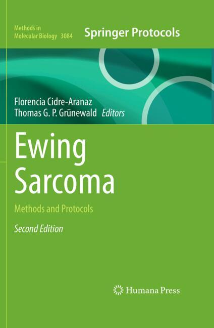 Ewing Sarcoma
