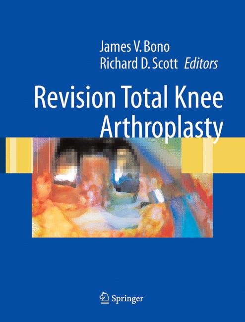Revision Total Knee… - image