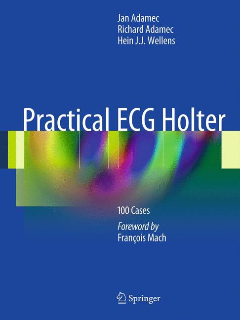 Practical Ecg Holter