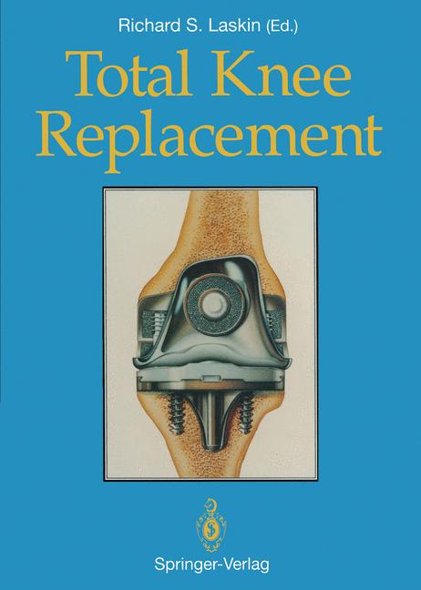 Total Knee Replacem… - image