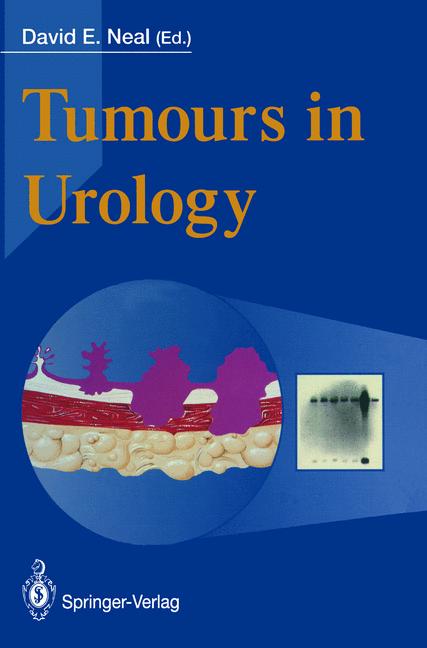 Tumours In Urology