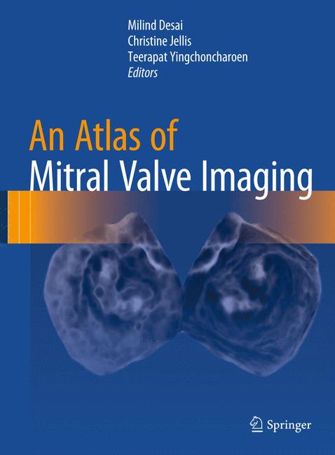 An Atlas Of Mitral … - image