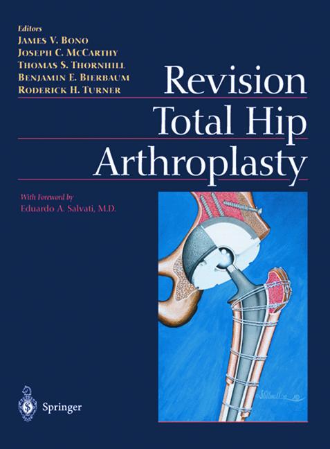 Revision Total Hip … - image