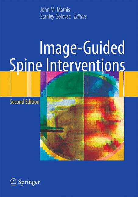Image-Guided Spine …