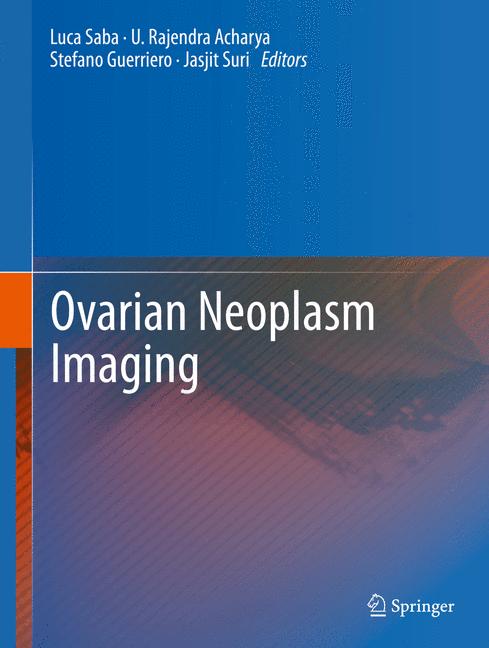 Ovarian Neoplasm Im…