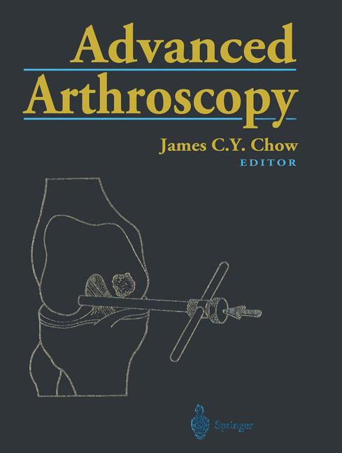 Advanced Arthroscopy - image