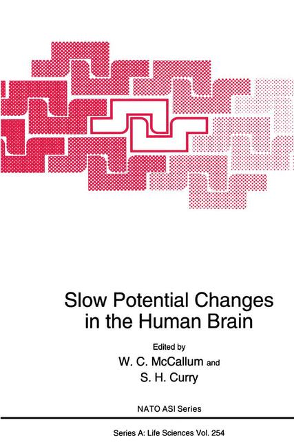 Slow Potential Chan… - image