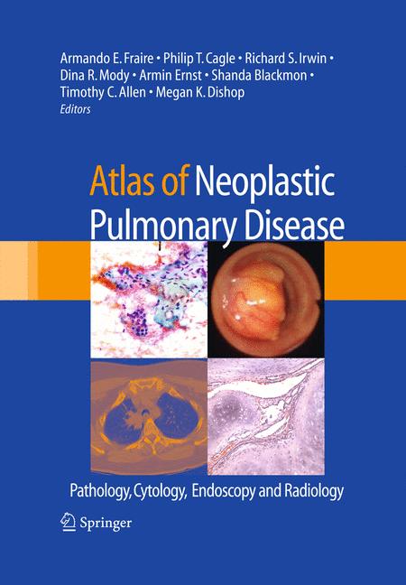 Atlas Of Neoplastic… - image