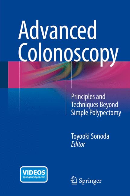 Advanced Colonoscopy - image