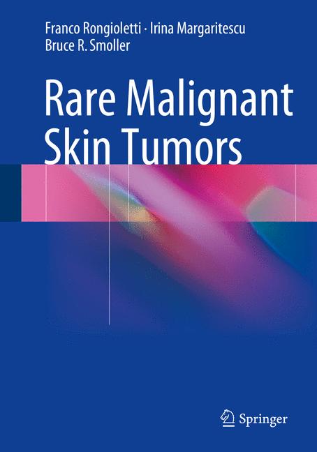 Rare Malignant Skin… - image