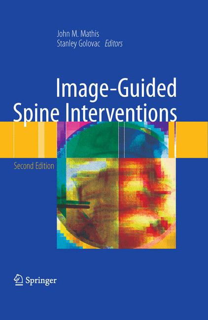 Image-Guided Spine …