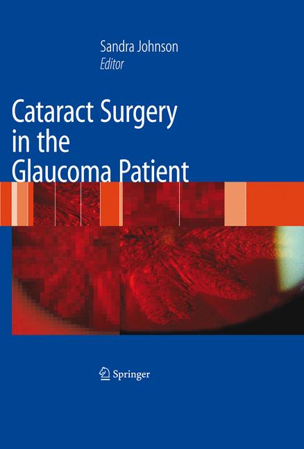 Cataract Surgery In…