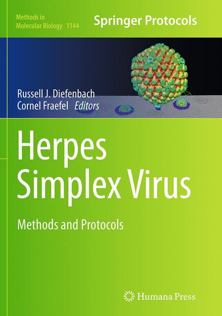 Herpes Simplex Virus