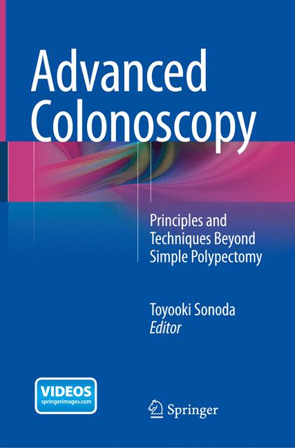 Advanced Colonoscopy - image