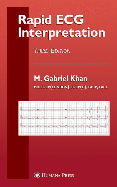 Rapid Ecg Interpret…