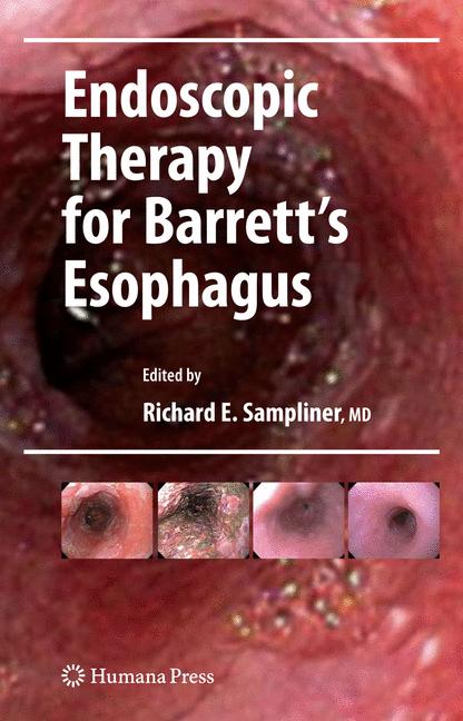 Endoscopic Therapy …