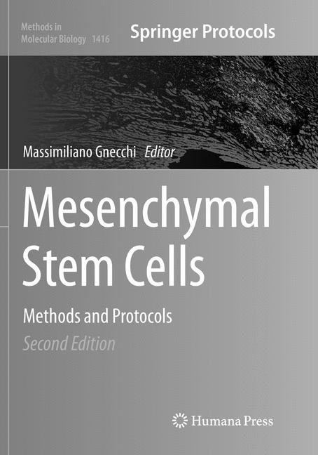 Mesenchymal Stem Ce…