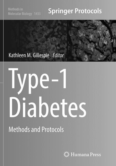 ISBN 9781493981045 product image for Type-1 Diabetes | upcitemdb.com