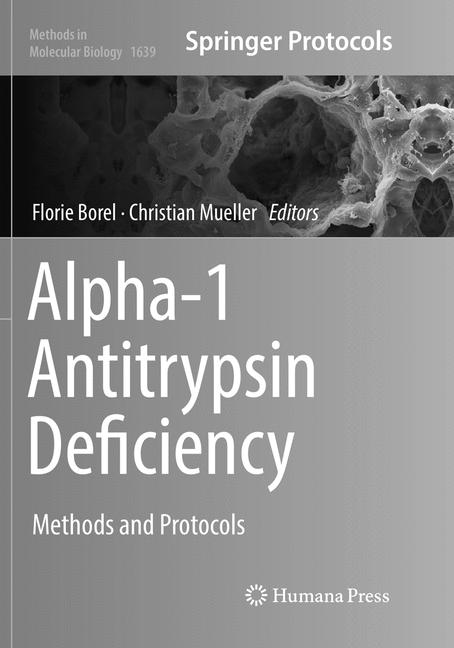 Alpha-1 Antitrypsin…