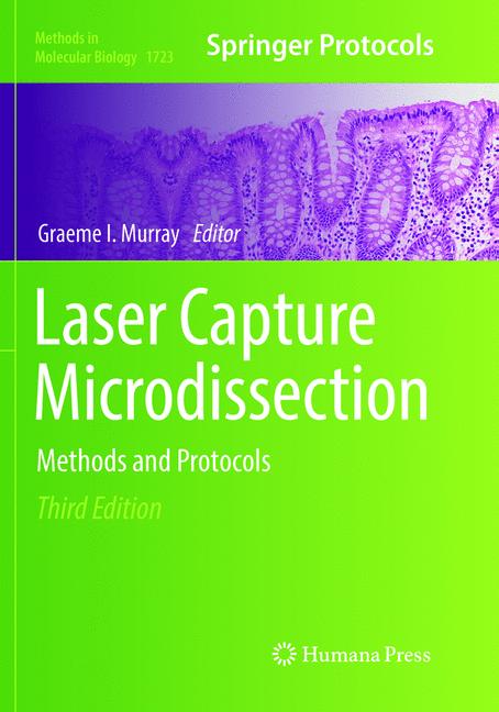 Laser Capture Micro…