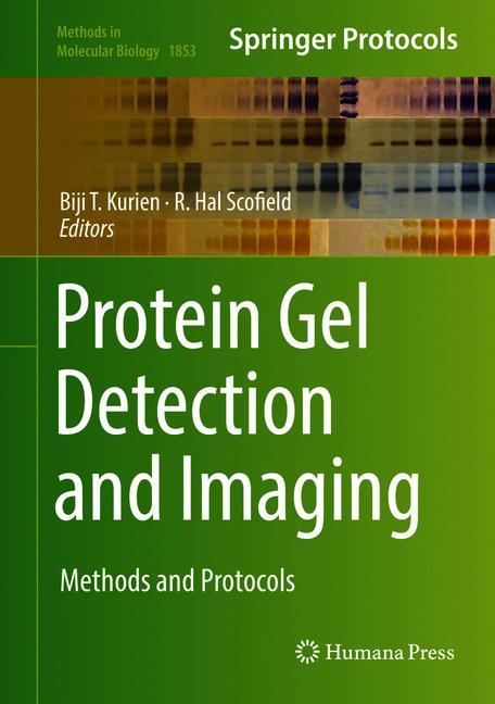 Protein Gel Detecti…