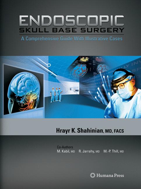 Endoscopic Skull Ba…