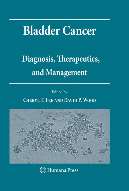 Bladder Cancer - image