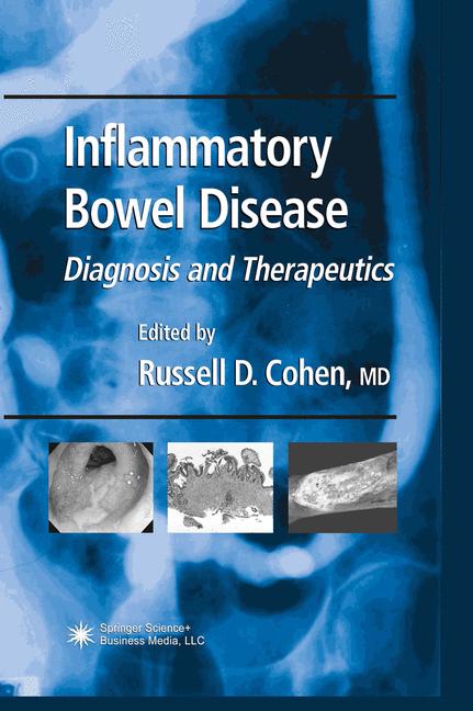 Inflammatory Bowel Disease : Diagnosis and Therapeutics