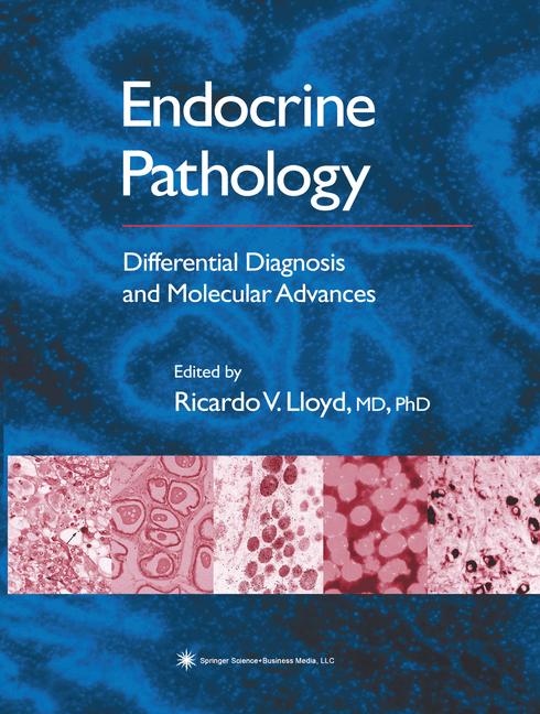 Endocrine Pathology - image
