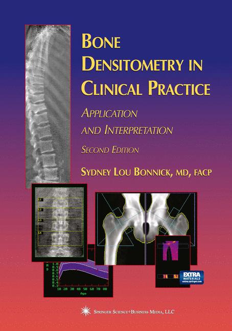 Bone Densitometry I… - image