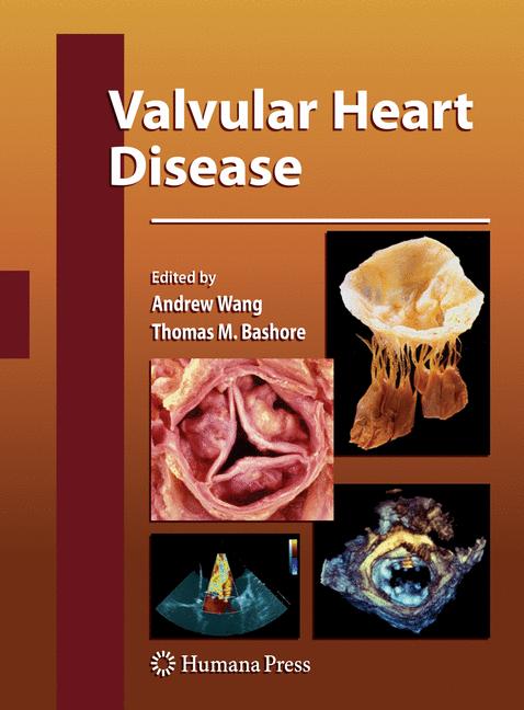 Valvular Heart Dise…