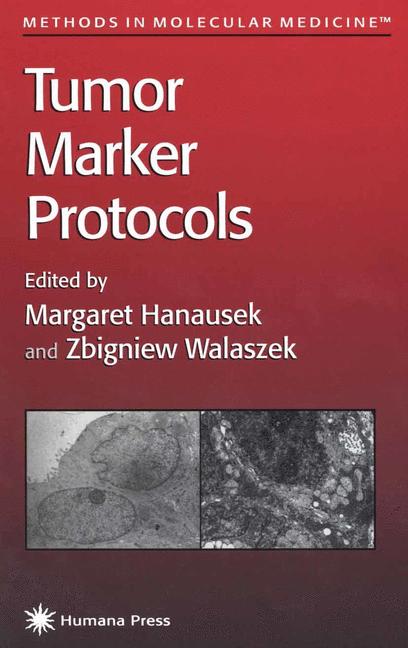 Tumor Marker Protoc…