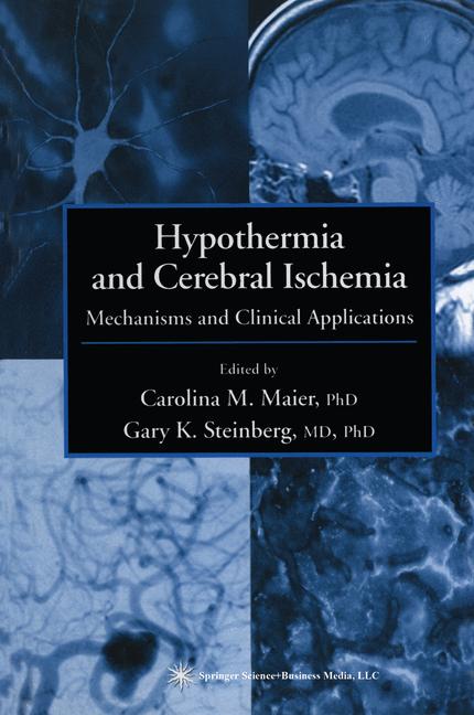 Hypothermia And Cer… - image