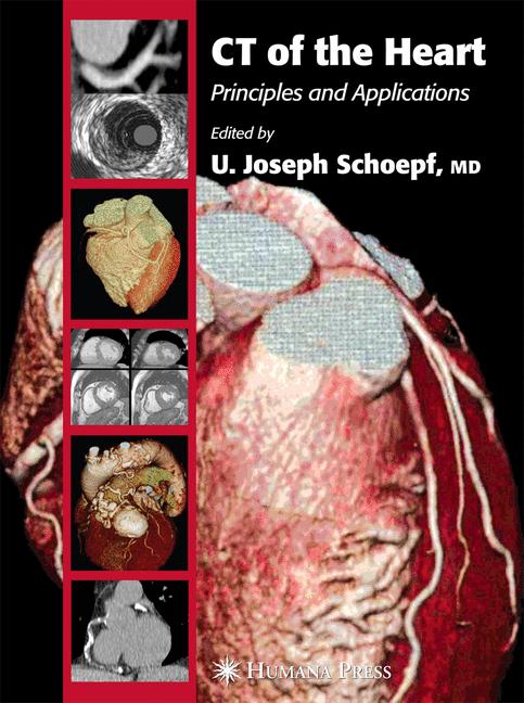 Ct Of The Heart - image