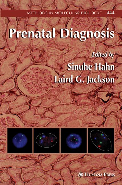 Prenatal Diagnosis - image